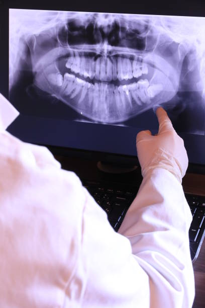 Best Chipped Tooth Repair Near Me  in Terre Haute, IN
